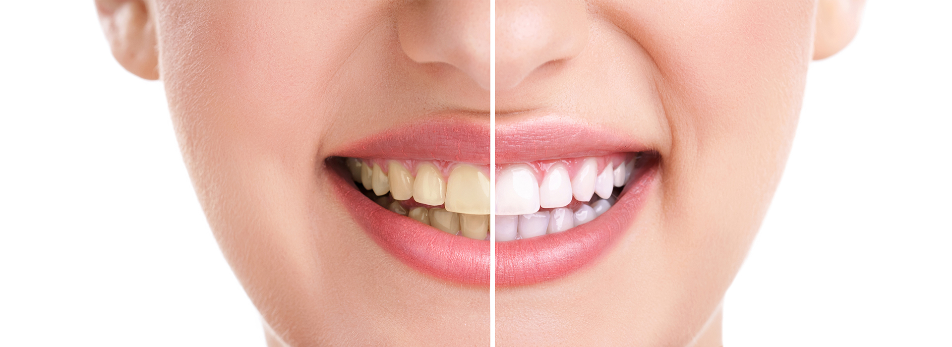 Central Park Dental Aesthetics | Laser Dentistry, Extractions and Complete Partial Dentures