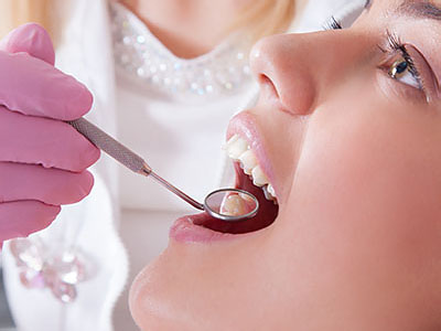 Central Park Dental Aesthetics | Sinus Augmentation, Restorations and Porcelain Crowns Caps